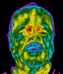 Thermal image of tear duct for elevated body temperature screening