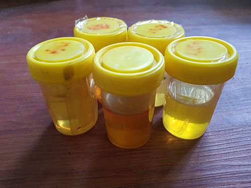 several sample oil to analysis and tribology test
